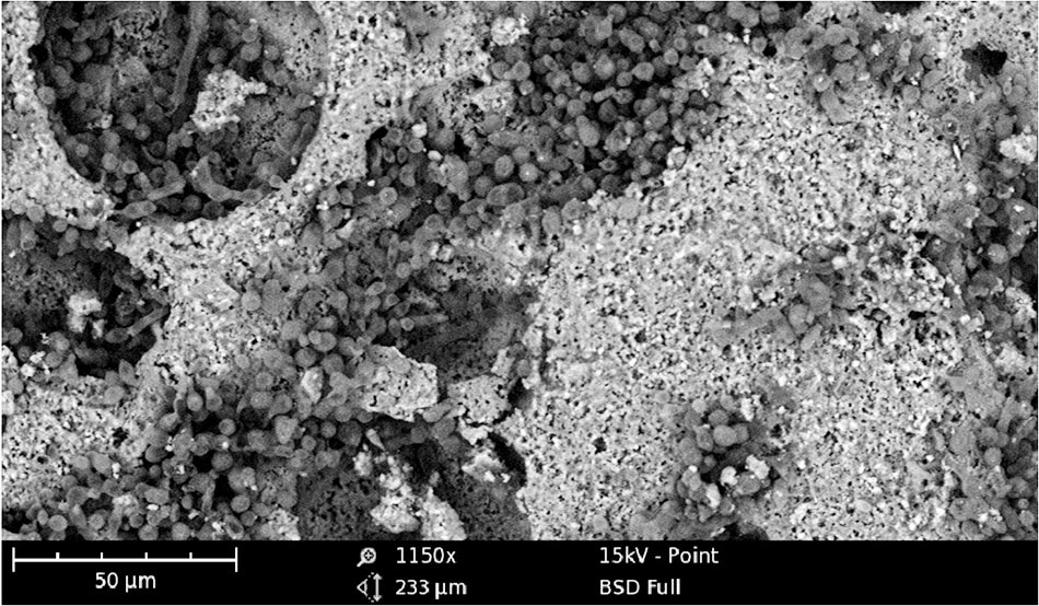 Le lichen sur les façades, vue au microscope, Grossissement X 1150