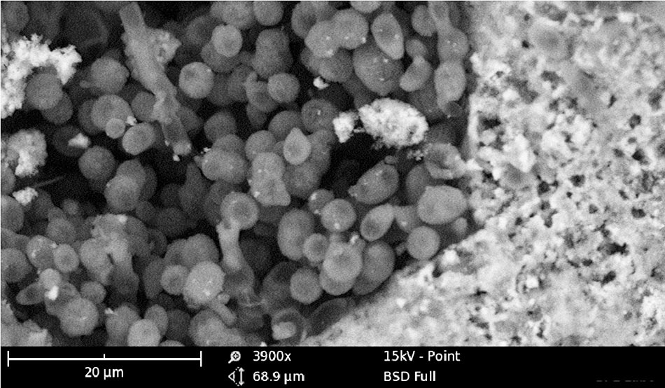 Le lichen sur les façades, vue au microscope, Grossissement X 3900